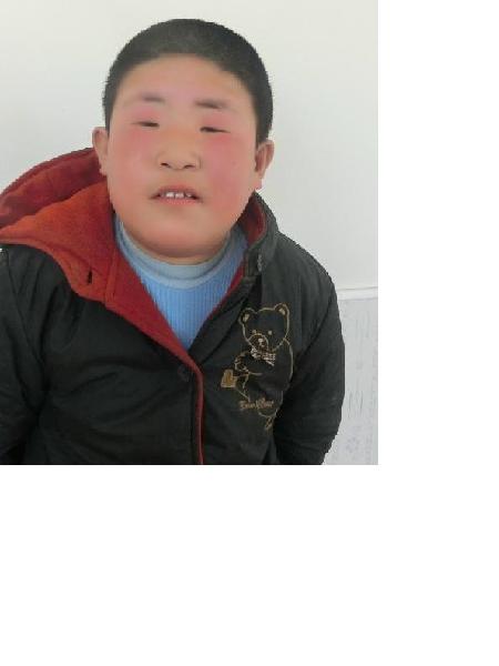 流浪人员小胖照片，让爱回家