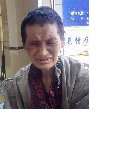 流浪人员无名女照片，让爱回家