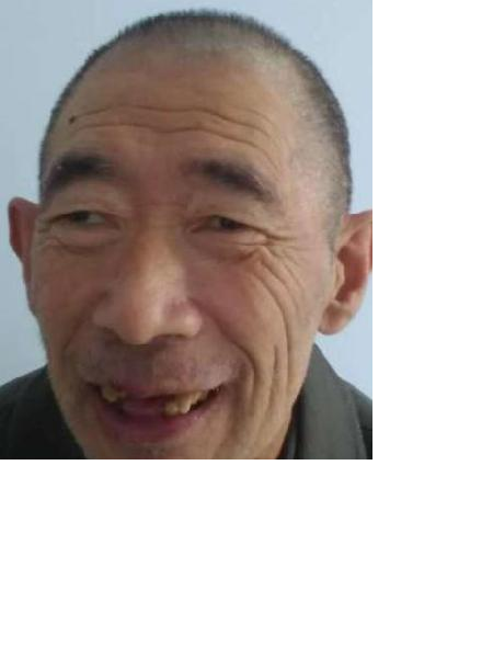 流浪人员无名氏7照片，让爱回家
