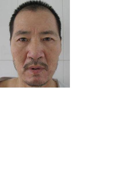 流浪人员无名氏照片，让爱回家