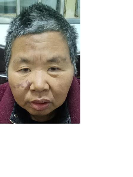 流浪人员吴金女3照片，让爱回家