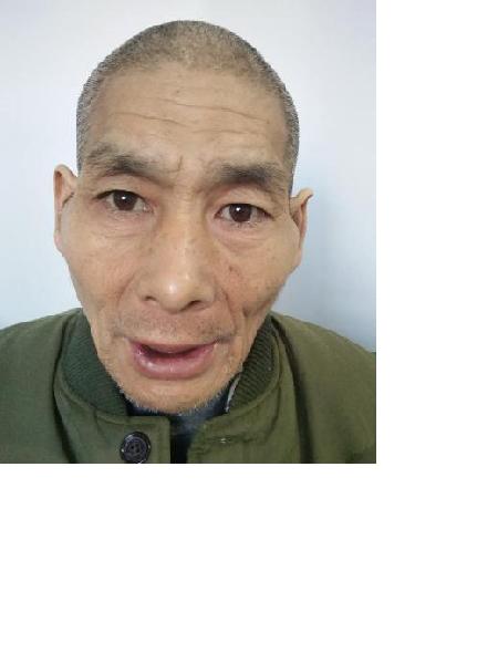 流浪人员党临和照片，让爱回家