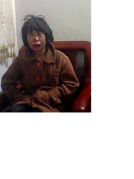 流浪人员无名氏（女）照片，让爱回家