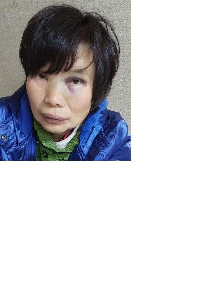 流浪人员无名女150照片，让爱回家
