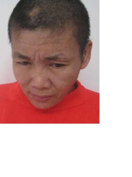 流浪人员断手0029-76826-22照片，让爱回家