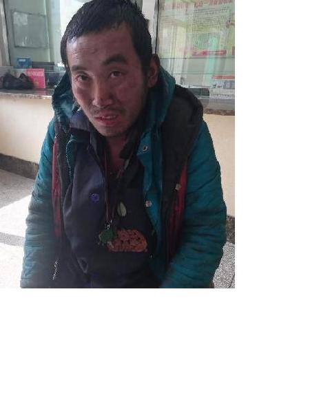 流浪人员无名照片，让爱回家