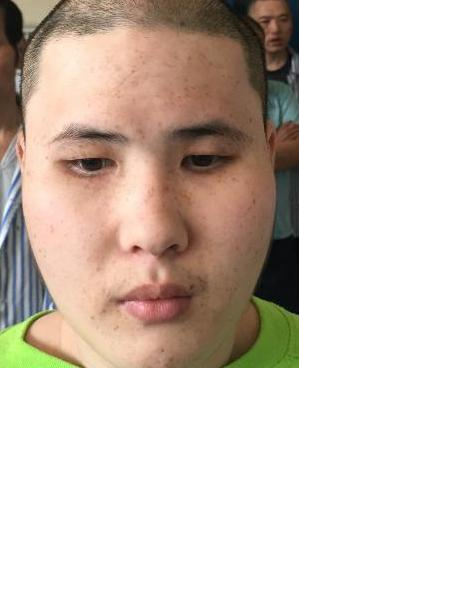 流浪人员04无名氏男康复医院照片，让爱回家