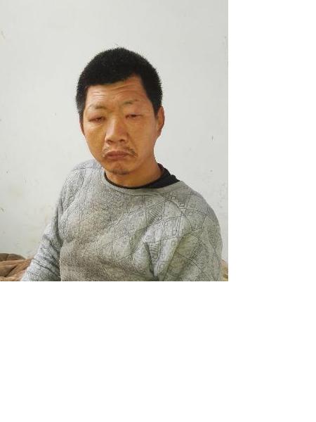 流浪人员无名男照片，让爱回家