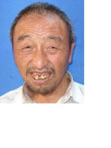 流浪人员救虹阳008照片，让爱回家