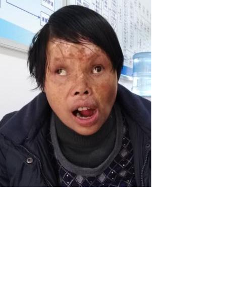 流浪人员无名氏（铜吉安）照片，让爱回家