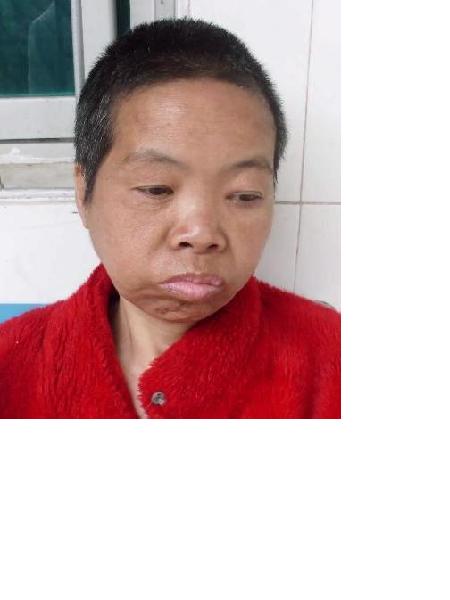 流浪人员康小巧照片，让爱回家