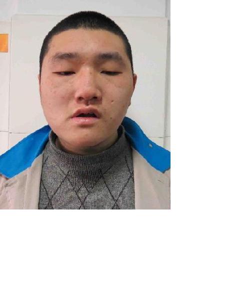 流浪人员救助348照片，让爱回家