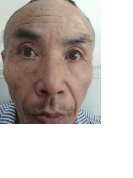 流浪人员无名氏男09照片，让爱回家