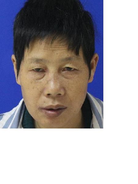 流浪人员衡救A173照片，让爱回家