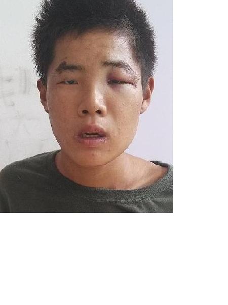 流浪人员无名男照片，让爱回家