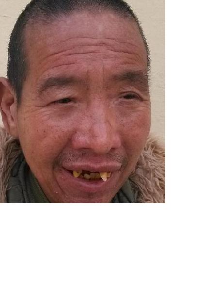 流浪人员无名男10照片，让爱回家