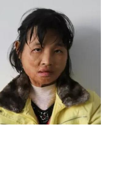 流浪人员旭石人照片，让爱回家