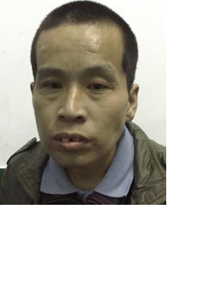 流浪人员中医院无名氏001照片，让爱回家