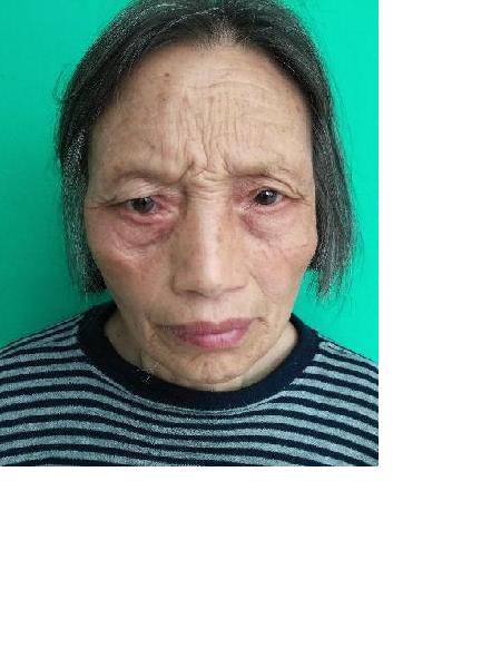 流浪人员无名氏18照片，让爱回家