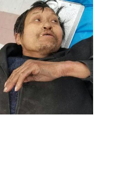 流浪人员无名氏（苟安）照片，让爱回家