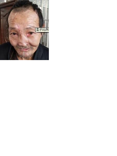 流浪人员无名70照片，让爱回家