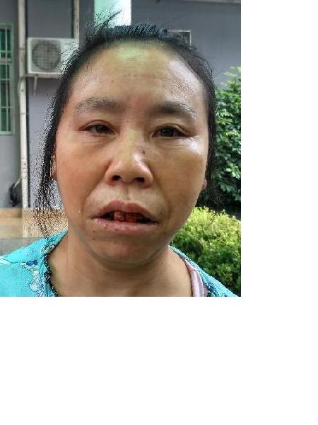 流浪人员无名女照片，让爱回家
