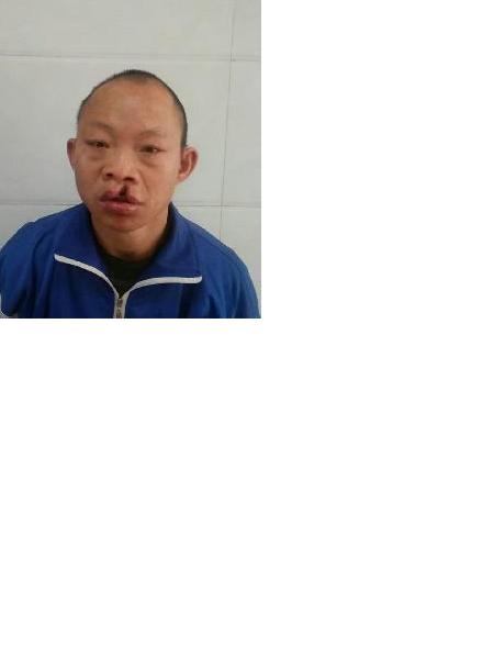 流浪人员毕救一照片，让爱回家