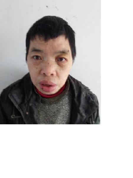 流浪人员无名氏照片，让爱回家