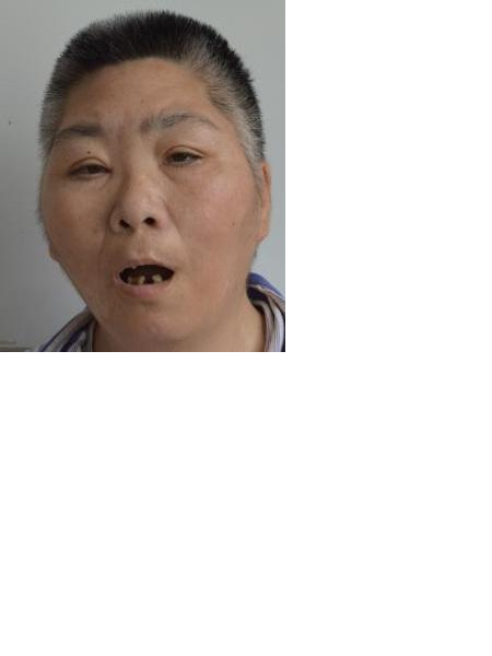流浪人员刘民雨照片，让爱回家
