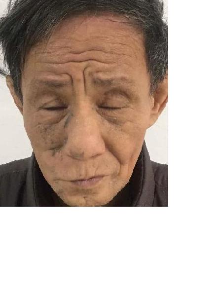 流浪人员041无名氏男（康复医院）照片，让爱回家