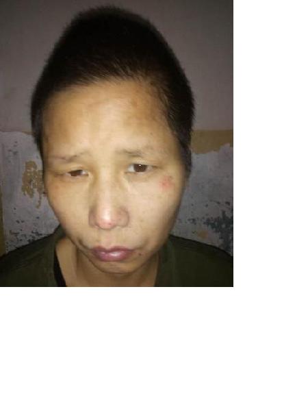流浪人员衡救A279照片，让爱回家