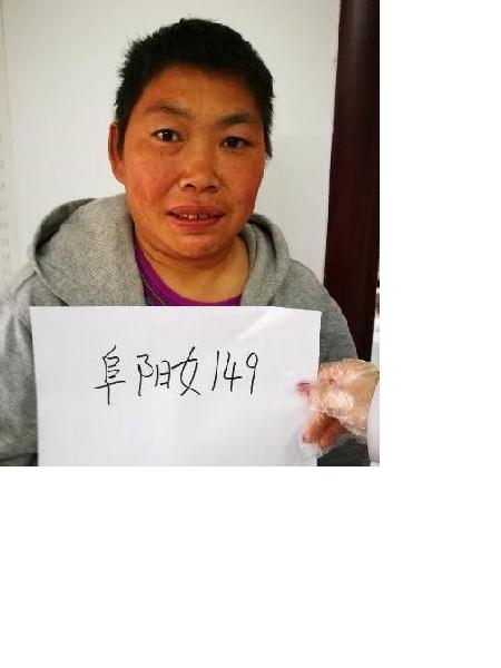 流浪人员阜阳女149照片，让爱回家