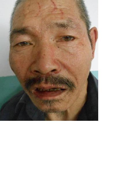 流浪人员无名氏10-4-9-1照片，让爱回家