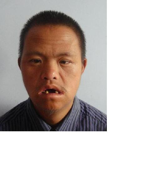 流浪人员阳金明照片，让爱回家