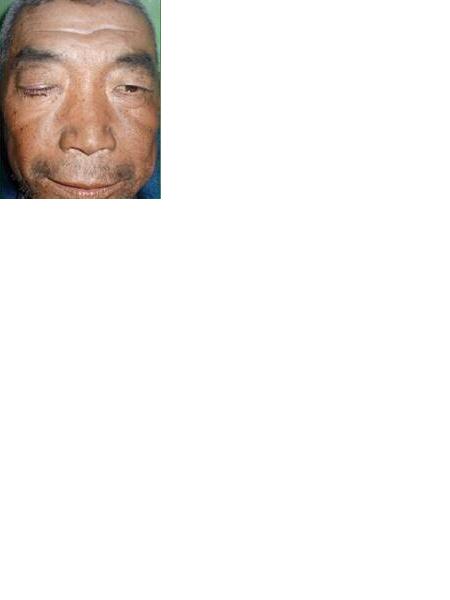流浪人员赵景文（寻亲）照片，让爱回家