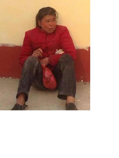 流浪人员党赵氏照片，让爱回家