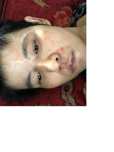流浪人员无名女瘫照片，让爱回家