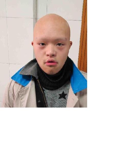 流浪人员救助325照片，让爱回家