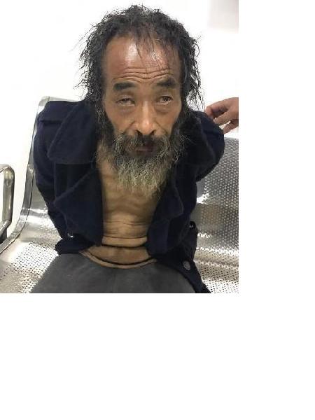 流浪人员无名氏（20170627）照片，让爱回家