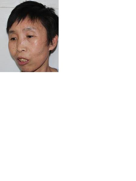流浪人员政哑巴女照片，让爱回家