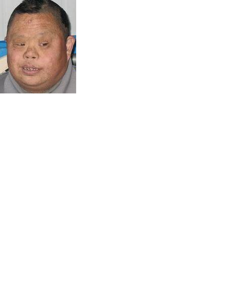 流浪人员无名氏照片，让爱回家