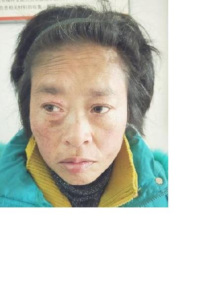 流浪人员无名氏（博能）照片，让爱回家