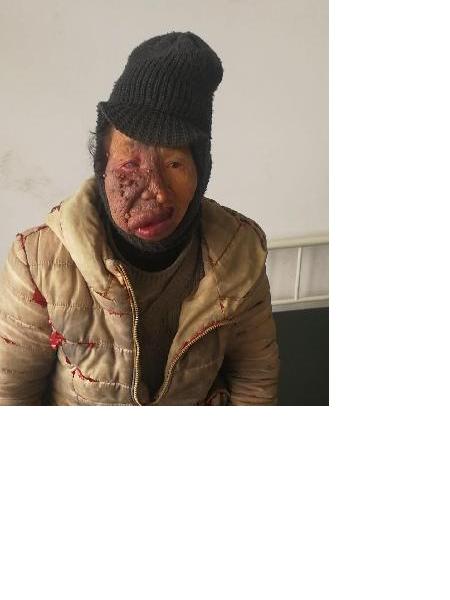 流浪人员无名氏20180105照片，让爱回家