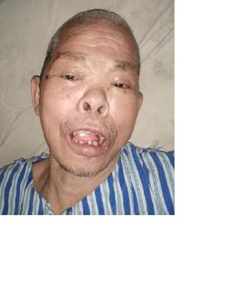 流浪人员侯荣泉照片，让爱回家