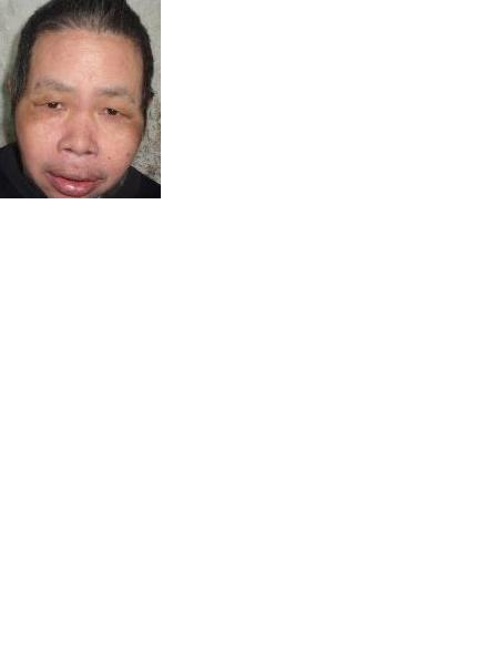 流浪人员90003481照片，让爱回家