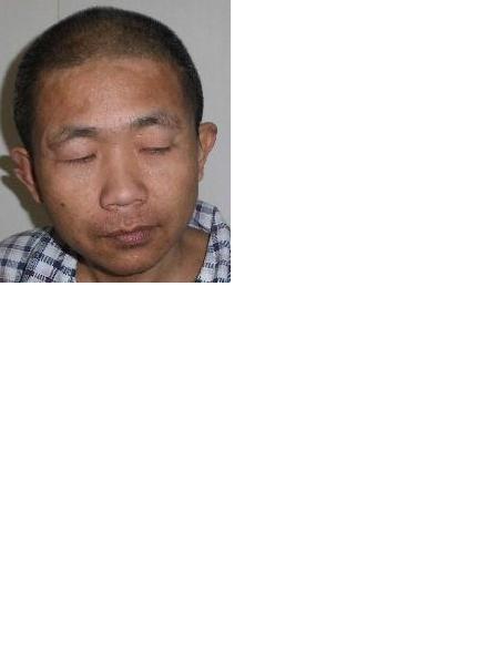 流浪人员三叉男照片，让爱回家