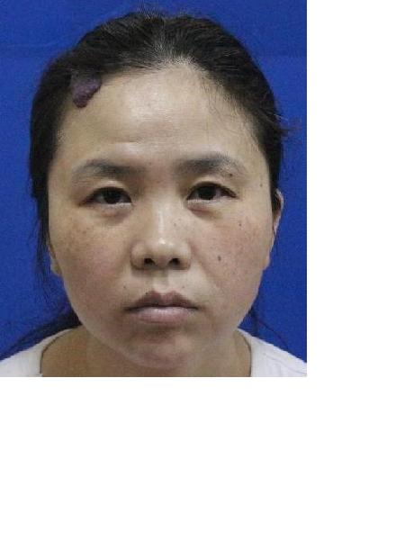 流浪人员衡救A224照片，让爱回家