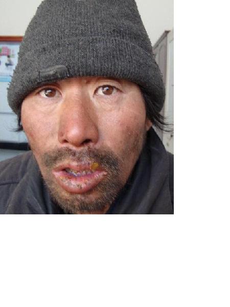 流浪人员董熙哲照片，让爱回家