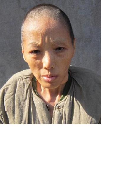 流浪人员无名男71号照片，让爱回家