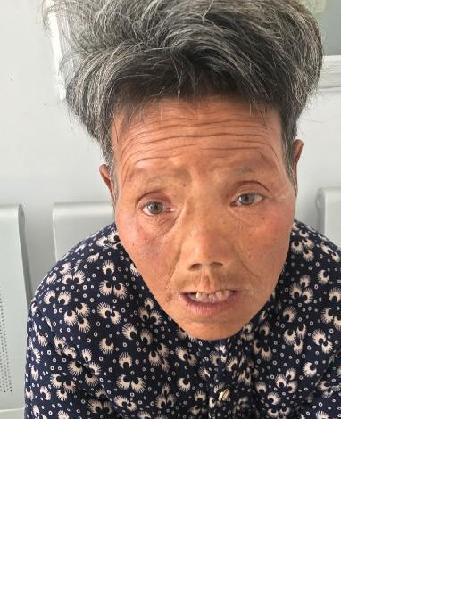 流浪人员助吴林照片，让爱回家